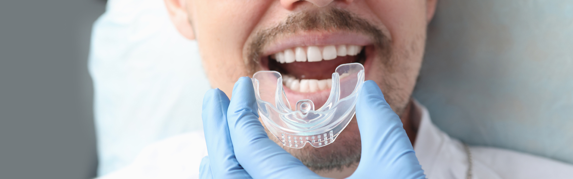 Mouth Guards