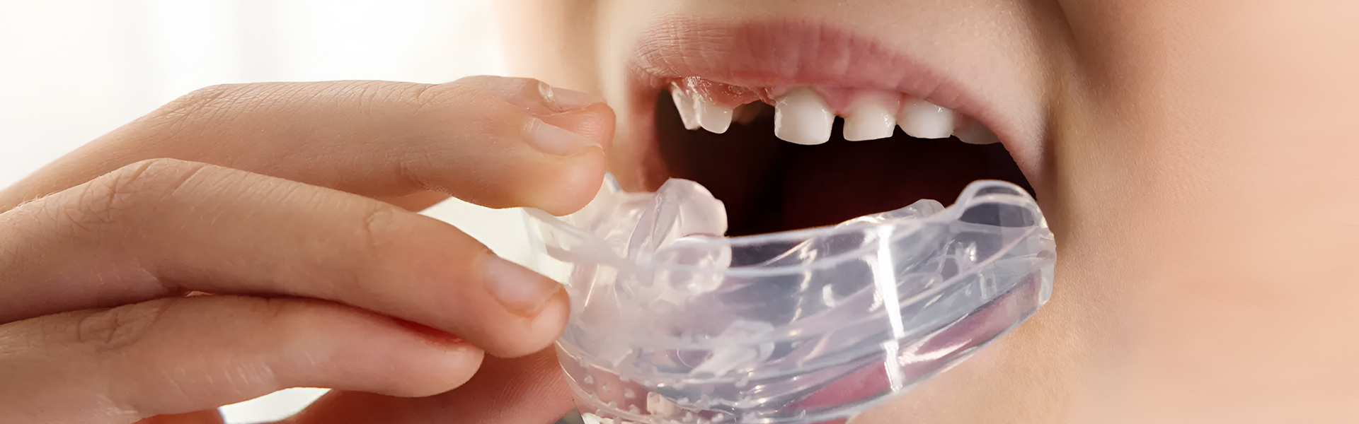 Pediatric Dental Appliances