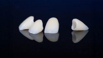 Can a Dental Crown Fall Off? Causes and What to Do
